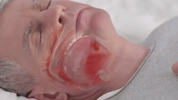 AirFlow Pro Anti Ronquidos