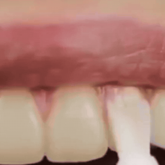 Sonrisa Radiante Mousse Dental