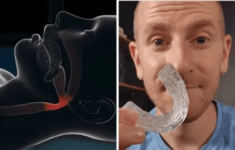 AirFlow Pro Anti Ronquidos