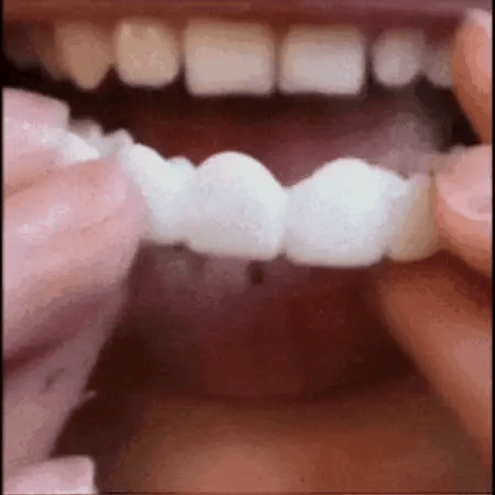 Dientes Falsos Sonrisa Instantánea
