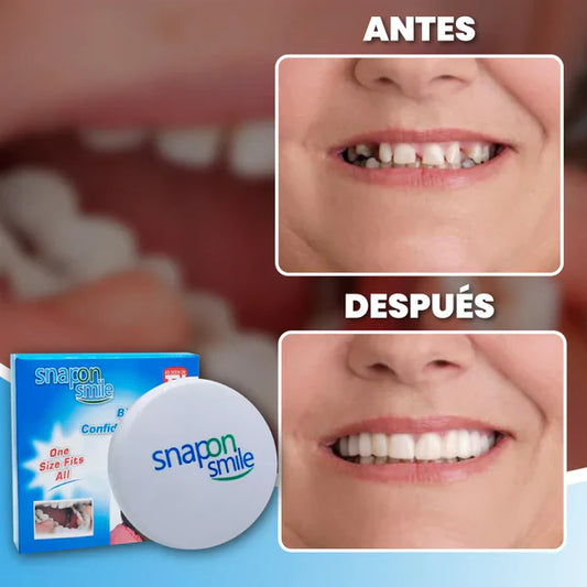 Carillas Dentales Pro Adaptables